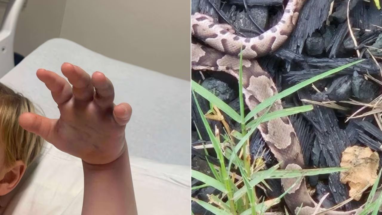 Snake Bites 4-Year-Old at Day Care in Stony Point; Family Outraged as 911 Was Never Called
