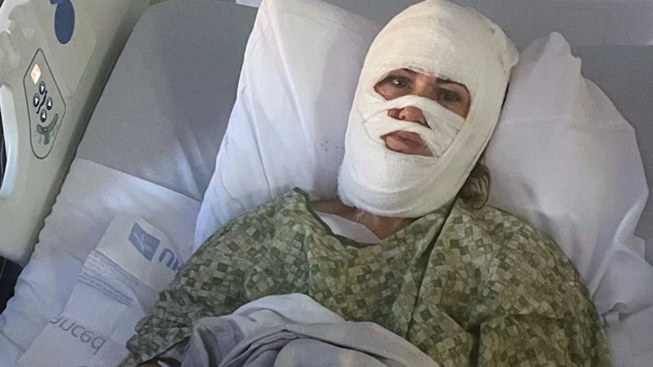 Georgia Woman Hospitalized After Corrosive Chemical Attack During Evening Walk Near Forsyth Park