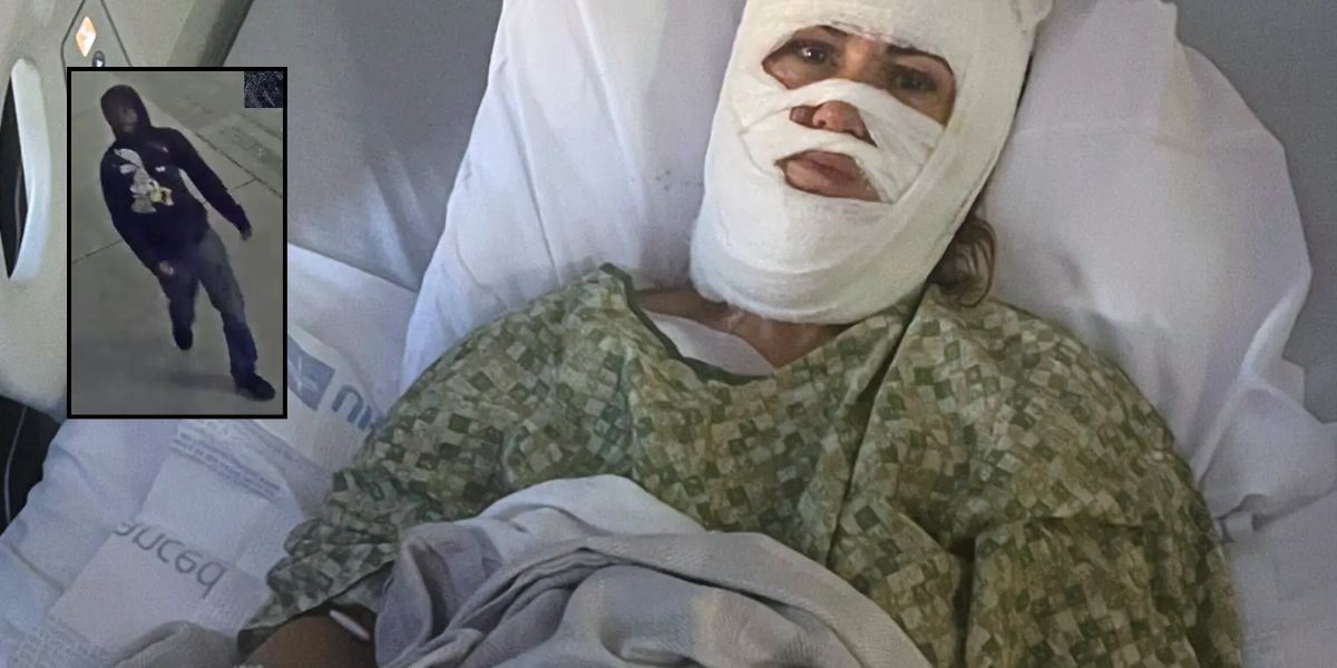 Georgia Woman Severely Burned in Random Park Attack; Suspect Remains at Large